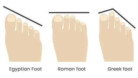 foot shape differences  morphology podexpert