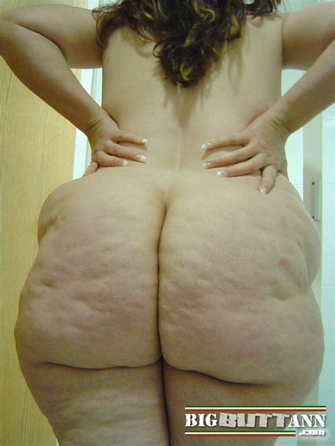 asses photo cellulite butts
