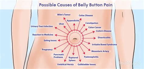 20 Possible Causes Of Pain Around The Belly Button Healdove