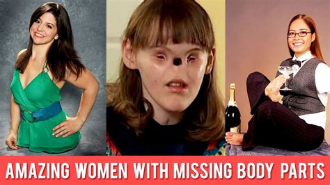 8 amazing women with missing body parts youtube