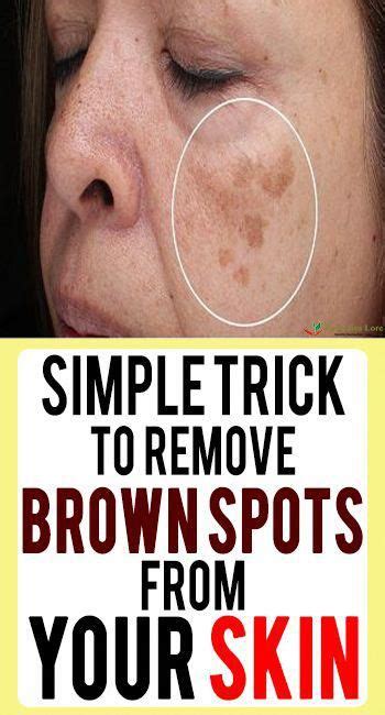 pin on raised brown spots on face