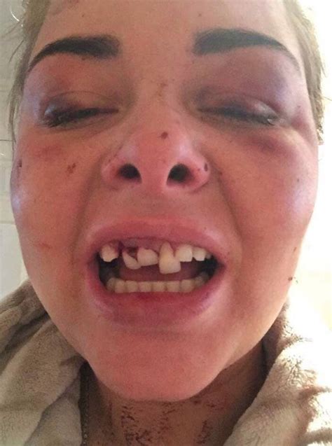 lois ashton brutally assaulted over facebook profile picture daily star