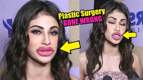 Mouni Roy Shocking Looks After Plastic Surgery Gone Wrong