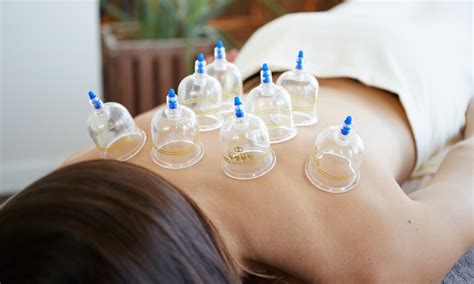 cupping therapy tampa rated 1 local for cupping
