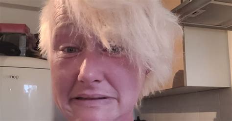 Woman Forced To Shave Off All Her Hair After Home Dye Bleach Job Goes