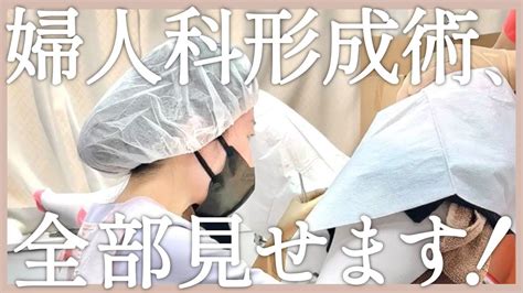【女性器のvio整形】小陰唇縮小術・副皮除去術の施術の様子を公開！【婦人科形成】 Youtube