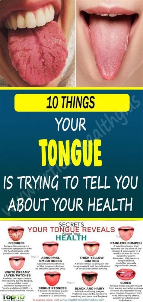 What Does Your Tongue Say About Your Health – The Best Foods House