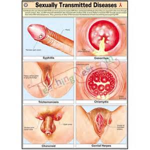 What do sexually transmitted disease look like