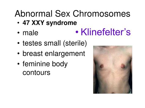 A Comprehensive Guide To Xxy Syndrome Causes Symptoms And Treatment