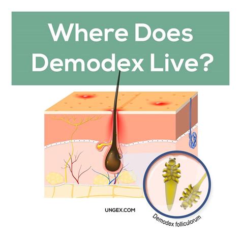 demodex mites life cycle food  remedy demodex demodex mites