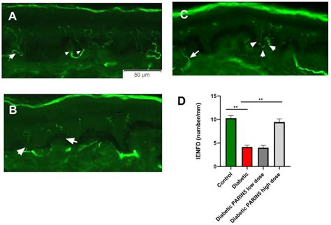 intraepidermal nerve fiber density ienfd skin biopsy images and