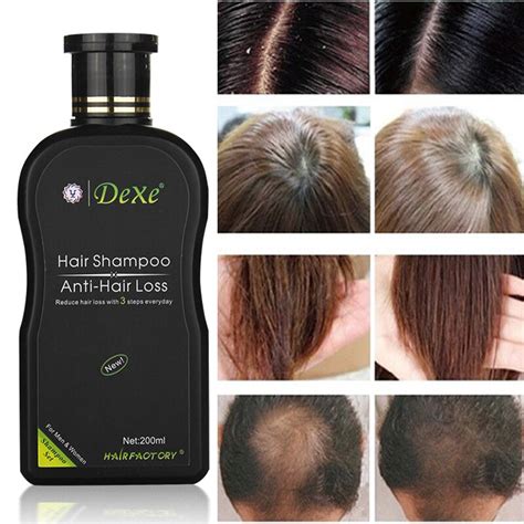 Dexe Hair Shampoo Anti Hair Loss Chinese Herbal Hair Growth Product