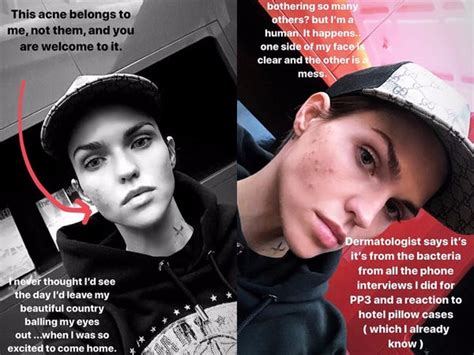 actress ruby rose bared her acne in a makeup free selfie business insider