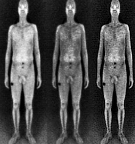 nude airport x rays photos naked cumception
