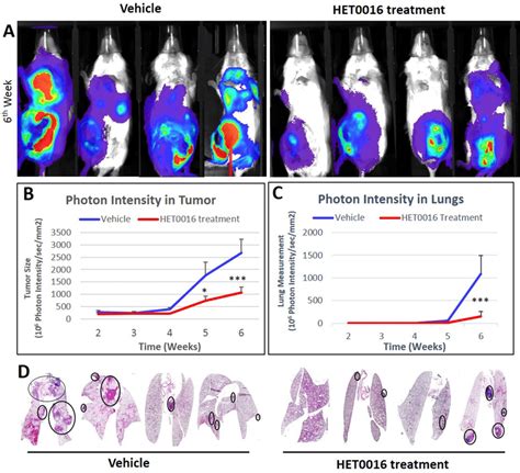 Tumor Size And Lung Metastasis Analysis Of Vehicle And Hpßcd Het0016