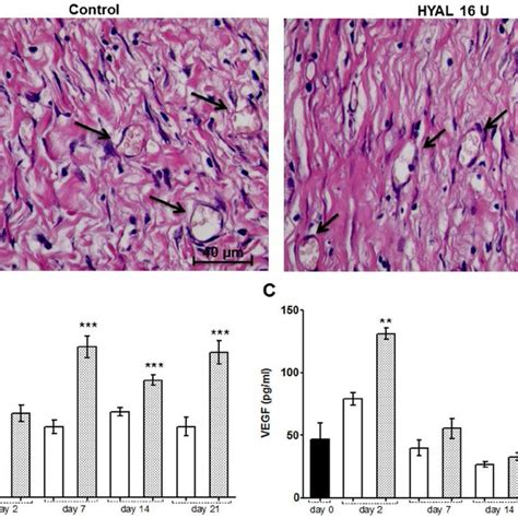 ppars gene expression in skin biopsies dissected from the cutaneous