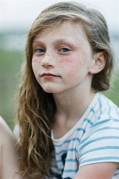 Portrait Of Pensive Young Redhead Girl With Freckles By Stocksy