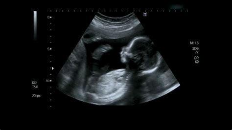 baby ultrasound     expecting  visits