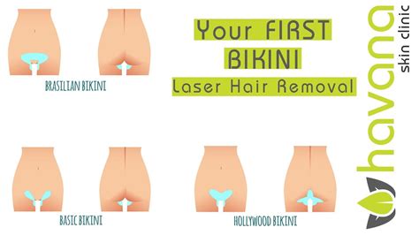 after before bikini area laser hair removal adult gallery