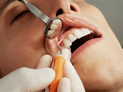 preventive dentistry    teeth clean   age