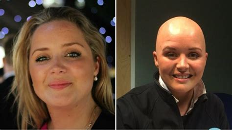 Shaving Head Gave Me Control Says Ni Alopecia Sufferer Bbc News