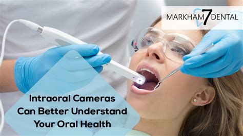 intraoral cameras   understand  oral health markham  dental