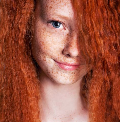 Exploring The Relationship Between Freckles And Red Hair A Closer Look