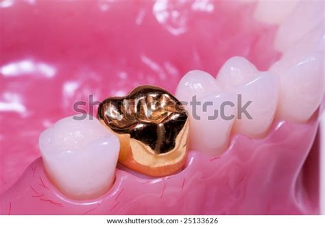 full gold crown fitted  model stock photo  shutterstock