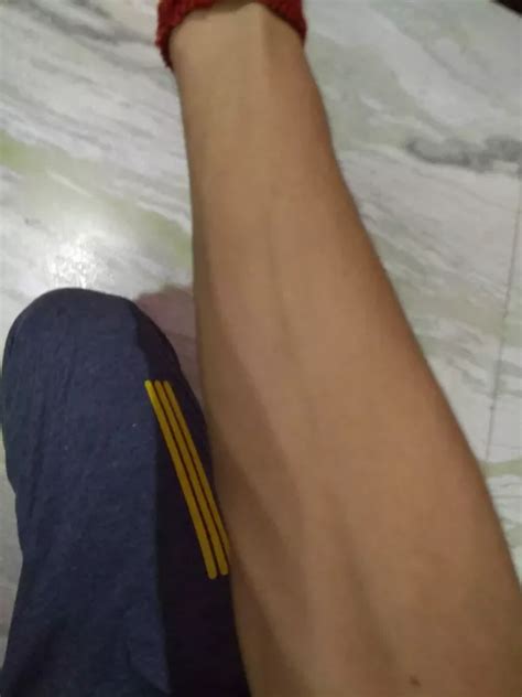 why are my veins very visible on my hands arms legs and feet quora