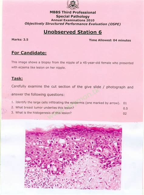 Medical College Stuff 4th Year Mbbs Pathology Special Pathology Ospe