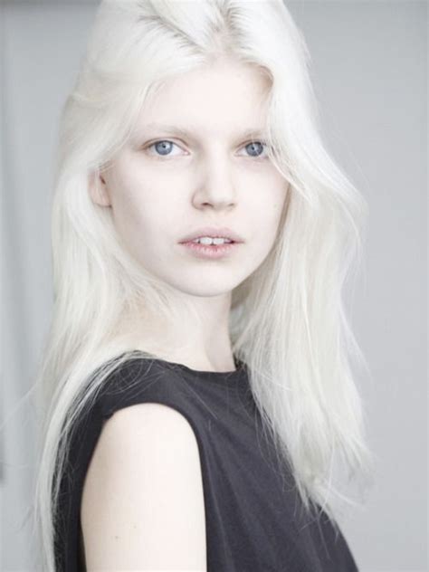 Sexy Albino Girls – Telegraph