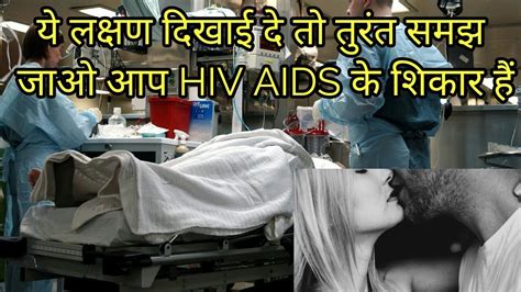 एड्स के लक्षण एच आई वी के लक्षण Aids Ke Lakshan Aids Symptoms Hiv Aids