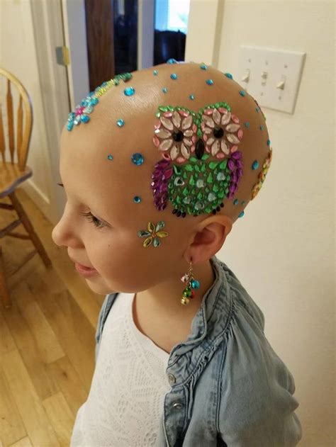 this 7 year old girl didn t let alopecia stop her from dazzling everyone at school on crazy hair