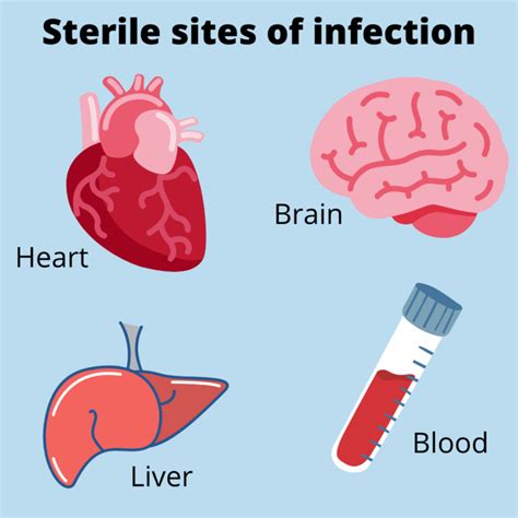 sterile   sterile sites