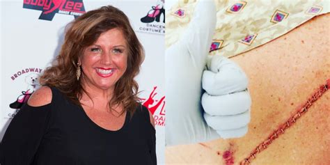 Abby Lee Miller Shares Emotional Recovery Photos After Surgery Self