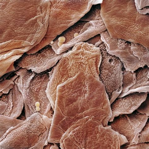 human skin cells sem stock image  science photo library