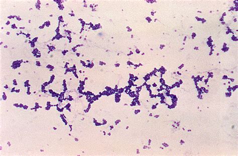 picture photomicrograph spherical cocci gram positive staphylococcus aureus