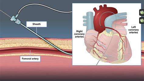 the principles of cardiac catheterization a d a m ondemand