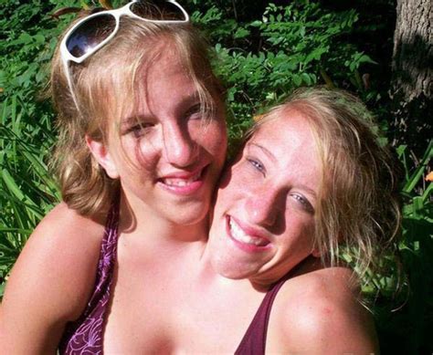 abby and brittany hensel british most famous conjoined twins foreign
