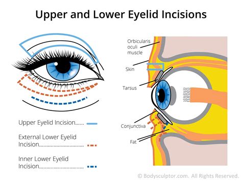 upper   eyelid surgery blepharoplasty  chicago eyelid surgery plastic surgery