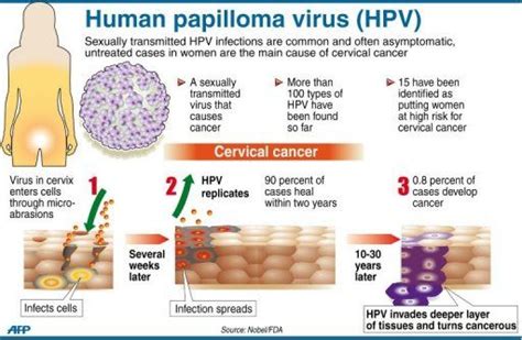 understanding hpv human papillomavirus health life media