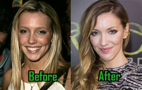 katie cassidy plastic surgery is too obvious to deny celebritysurgeryicon