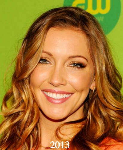 katie cassidy plastic surgery before and after photos