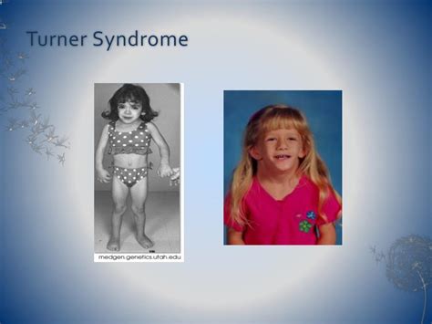 Ppt Craniofacial Disorders Powerpoint Presentation Free Download