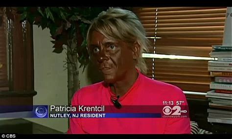 tan mom patricia krentcil has discovered botox and says her pale look