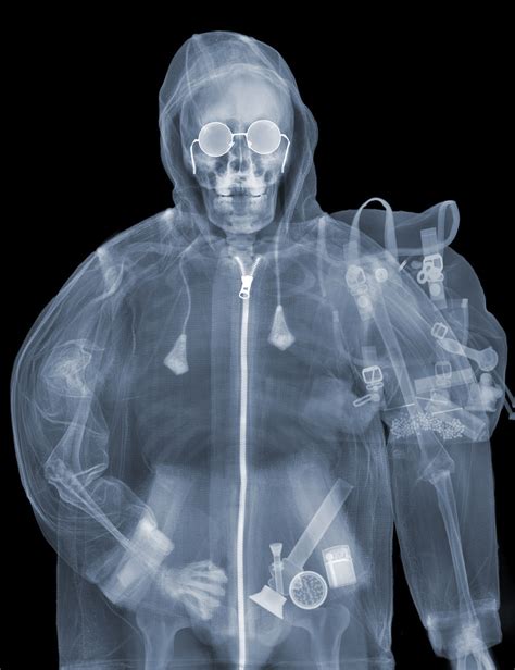 guy exposed    ray radiation   years     art blazepress