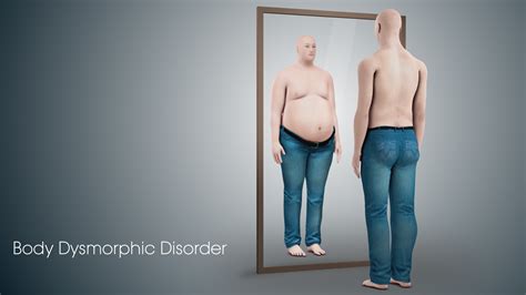 body dysmorphic disorder bdd symptoms causes and treatment
