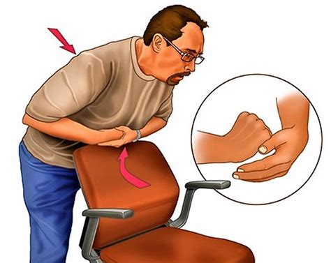 heimlich maneuver how to perform the heimlich maneuver