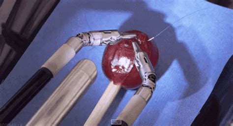 surgery find and share on giphy