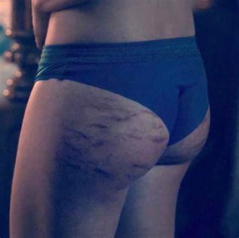 Yvonne Strahovski Ass Bruises Scene From The Handmaid S